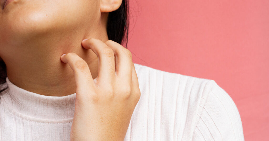 頌缽紅斑性狼瘡